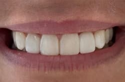 After