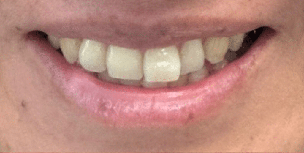 Before