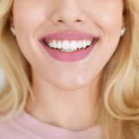 Unrecognizable blonde lady showing beautiful white teeth after treatment, sitting at dental chair, cropped, panorama. Woman attending modern dental clinic, having teeth whitening treatment
